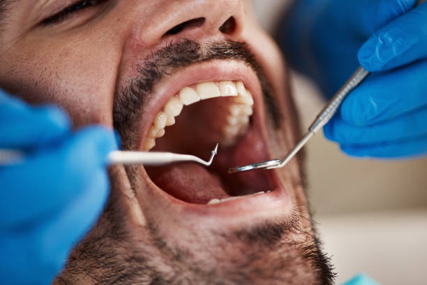 Best Emergency Treatment for Dental Infections or Abscesses in Lebanon, MO